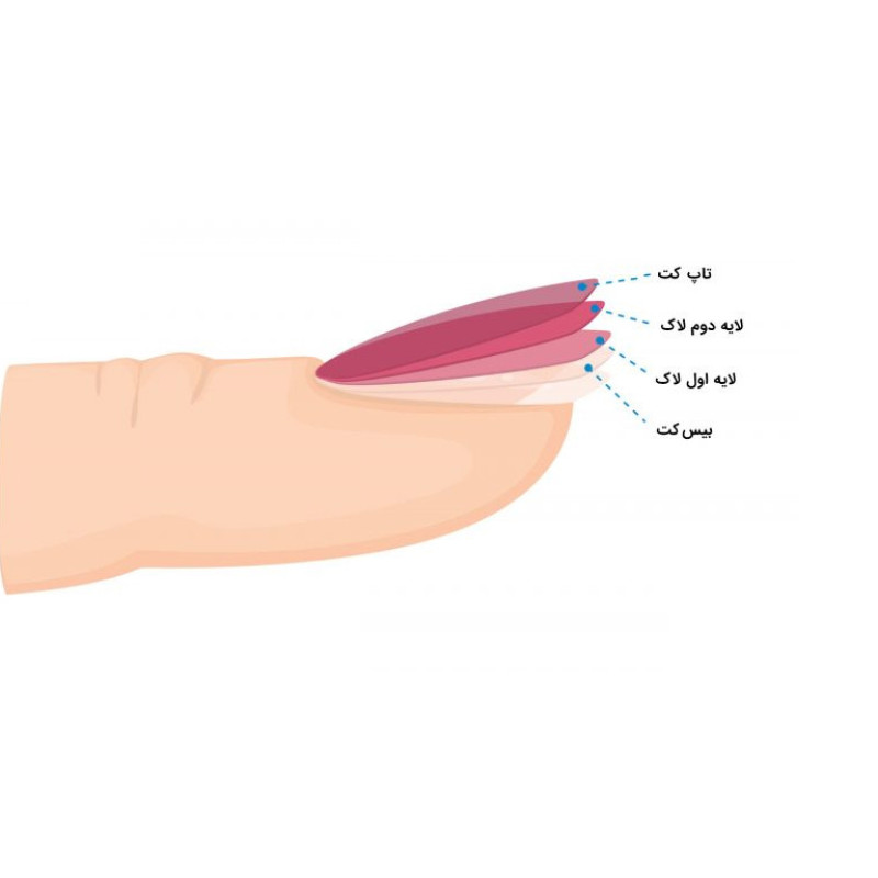 بیس کت ایویلانج مدل 001