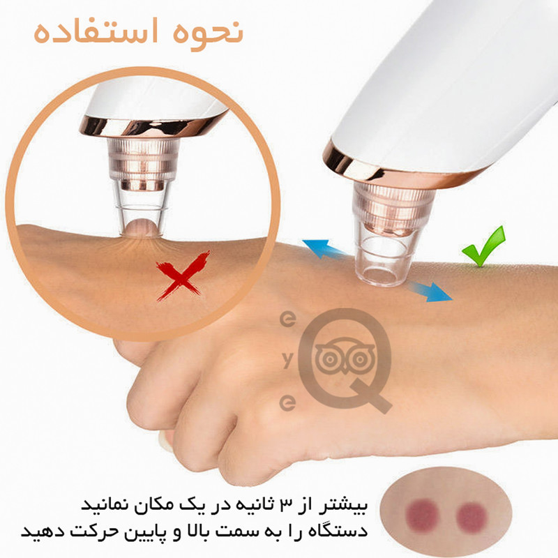 میکرودرم خانگی آی کیو مدل Smart-Cleaner به همراه دستگاه بخور صورت