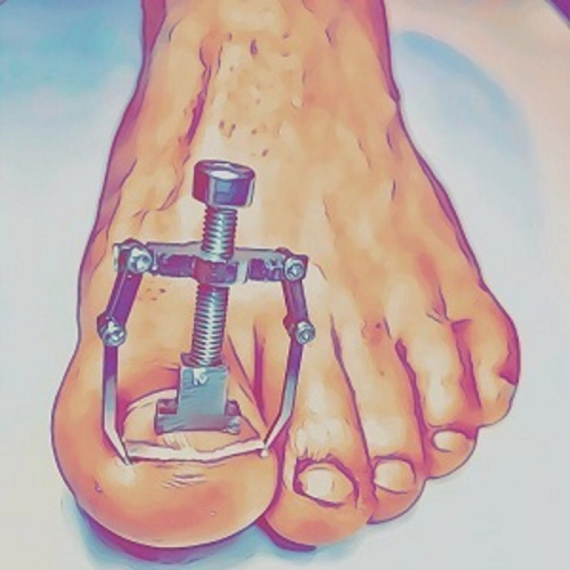 ارتودنسی ناخن مدل MO-27468