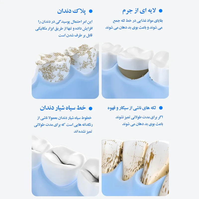 دستگاه جرم گیر دندان شارژی کروی مون مدل sonicare