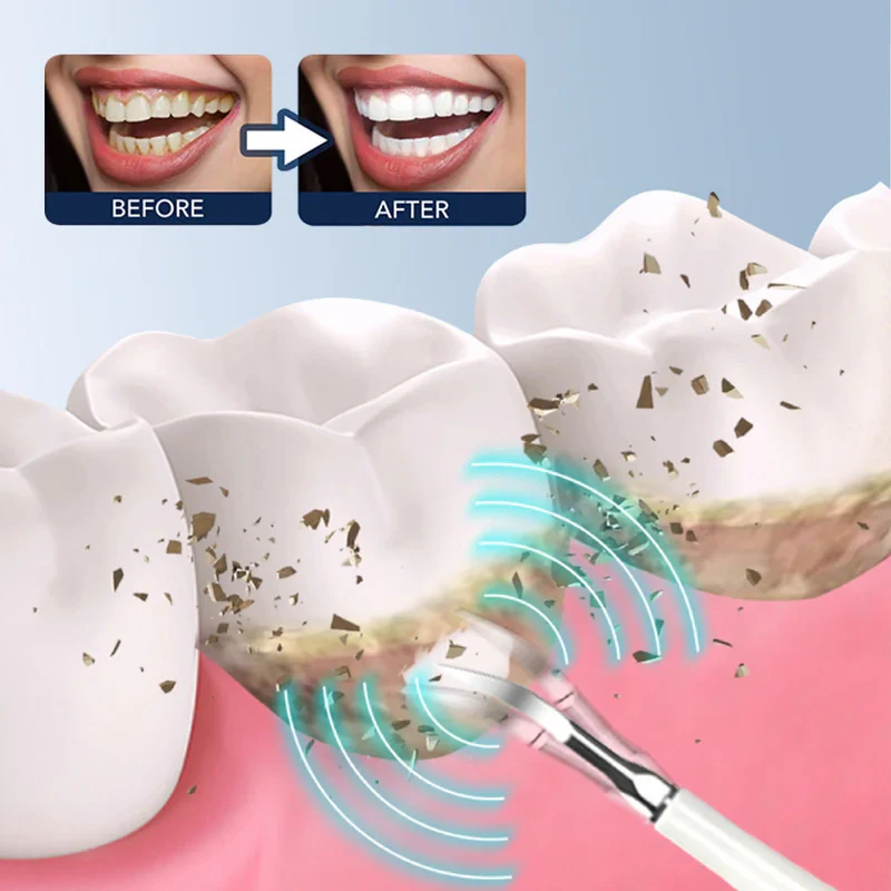 جرم گیر خانگی و مسواک برقی مدل LC-H228