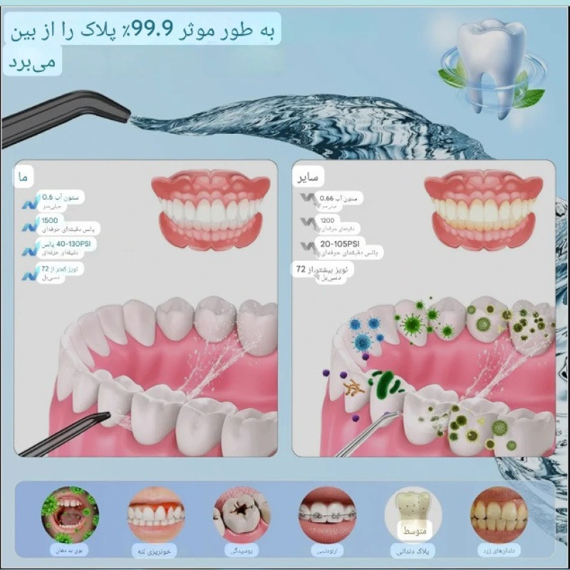 دستگاه شست‌وشوی دهان و دندان شارژی مدل C6SE-BT به همراه 4 سری