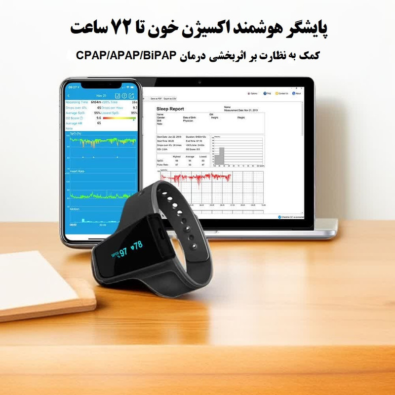 پالس اکسیمتر ولو مدل Checkme o2 max