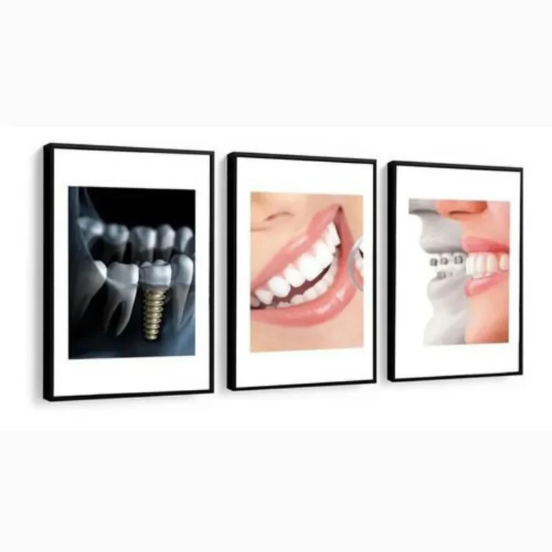تابلو مدل مطب دندانپزشکی کد 23 مجموعه 3 عددی