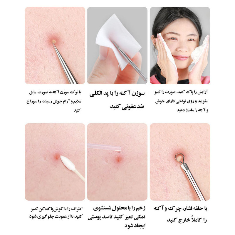 مجموعه ابزار پاک‌سازی پوست جیکومو مدل Anti-Acne بسته 8 عددی