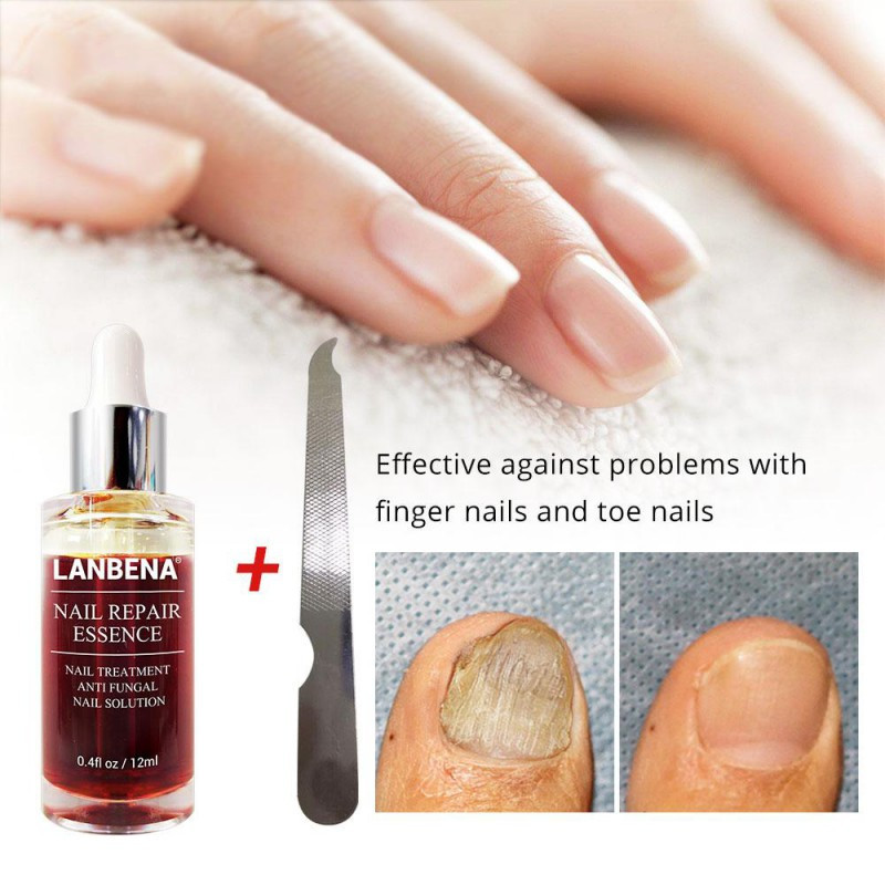 سرم ترمیم کننده ناخن لنبنا مدل Anti Fungal حجم 12 میلی لیتر