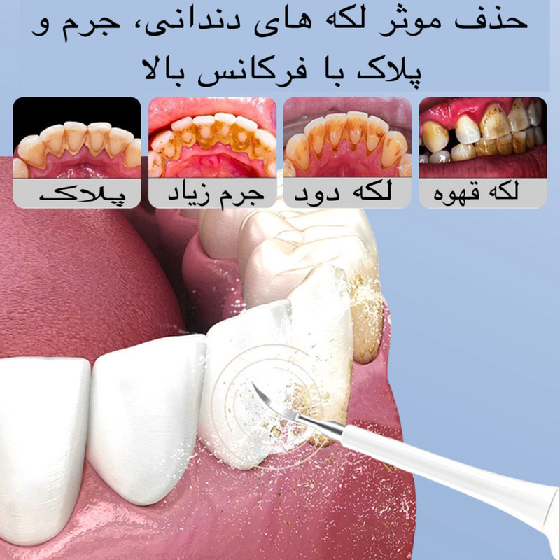 جرم گیر خانگی و مسواک برقی مدل LC-H228