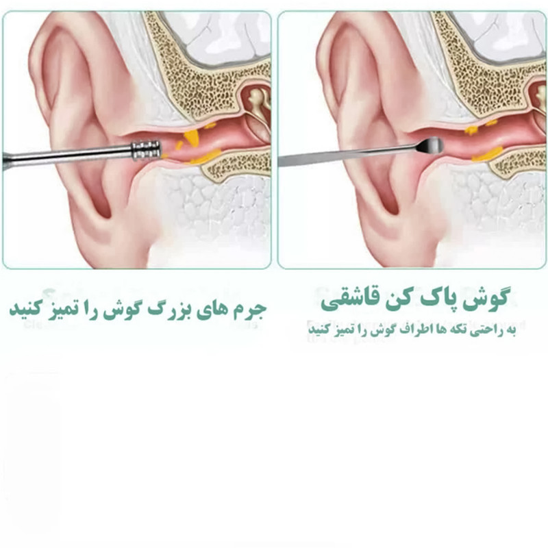 مجموعه نظافت گوش مدل Ear Care-02  بسته 6 عددی
