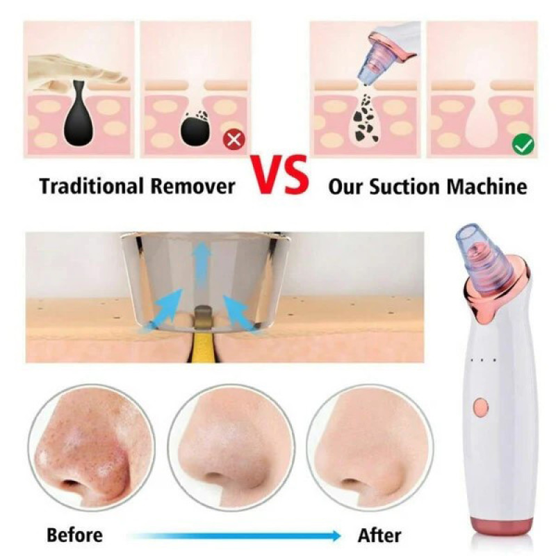 میکرودرم خانگی مدل BR-8821