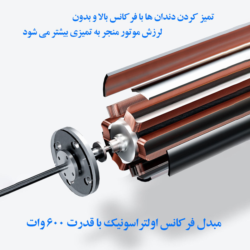 دستگاه جرم گیر دندان شارژی کروی مون مدل sonicare