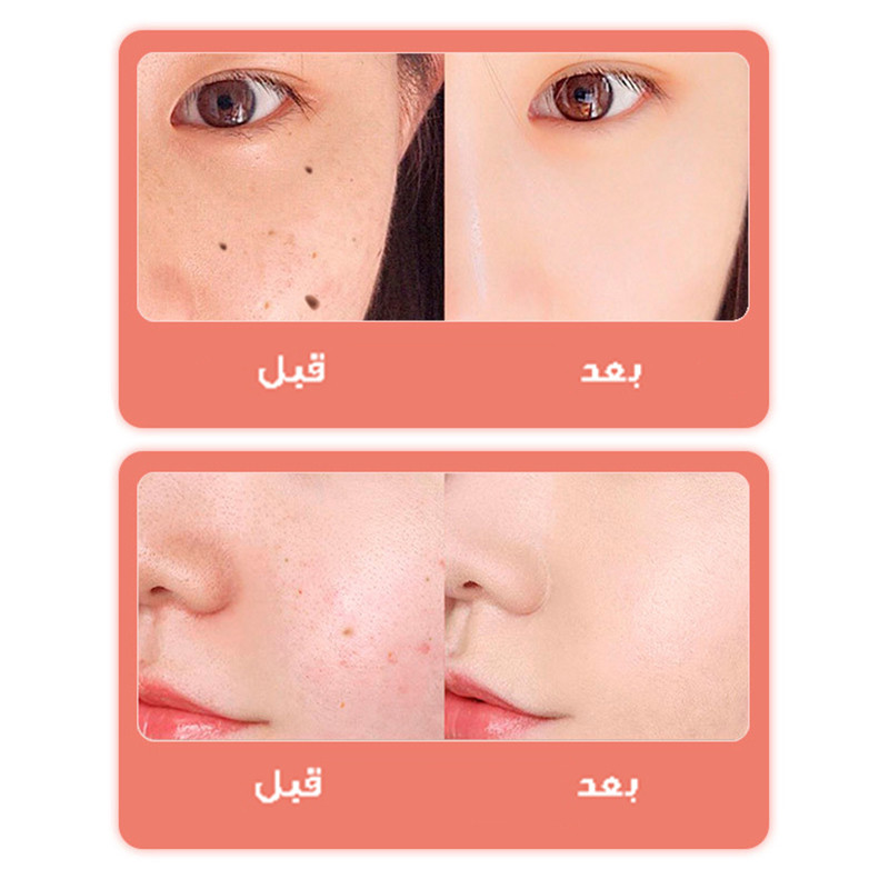 قلم پاک سازی پوست مدل دیجیتالی کد 9 سطح