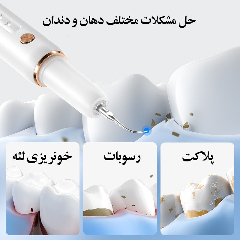دستگاه جرم گیر دندان شارژی کروی مون مدل sonicare