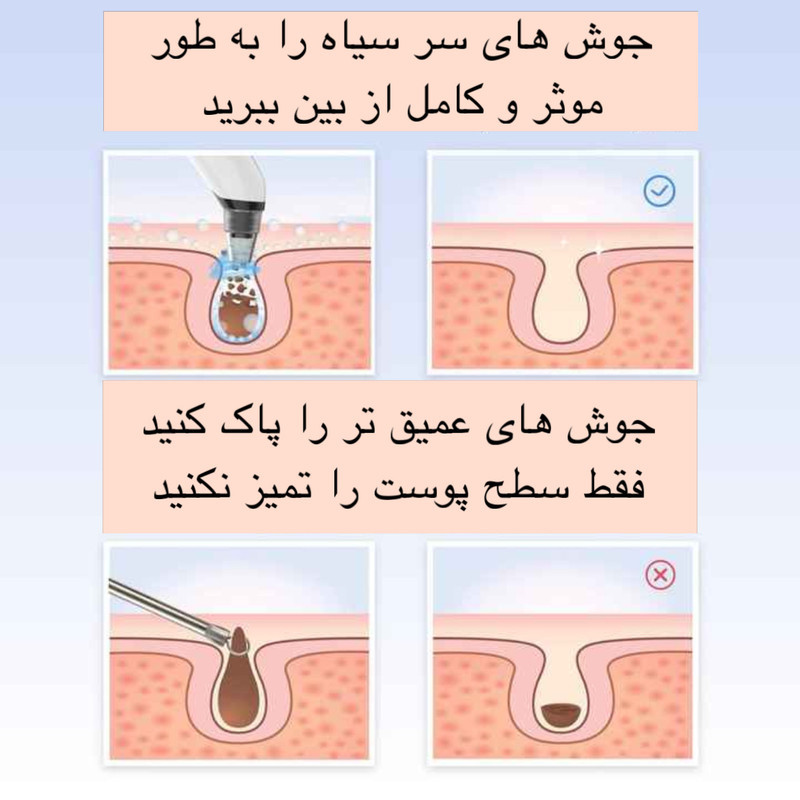 میکرودرم مدل X19