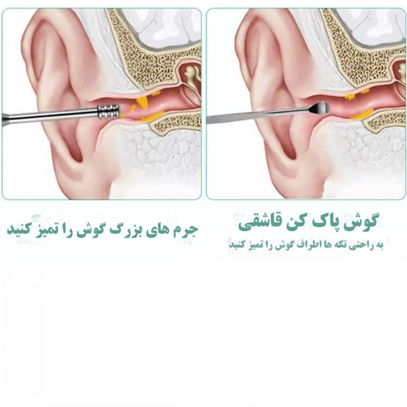 مجموعه نظافت گوش مدل MK-Ear-Brash  بسته 6 عددی