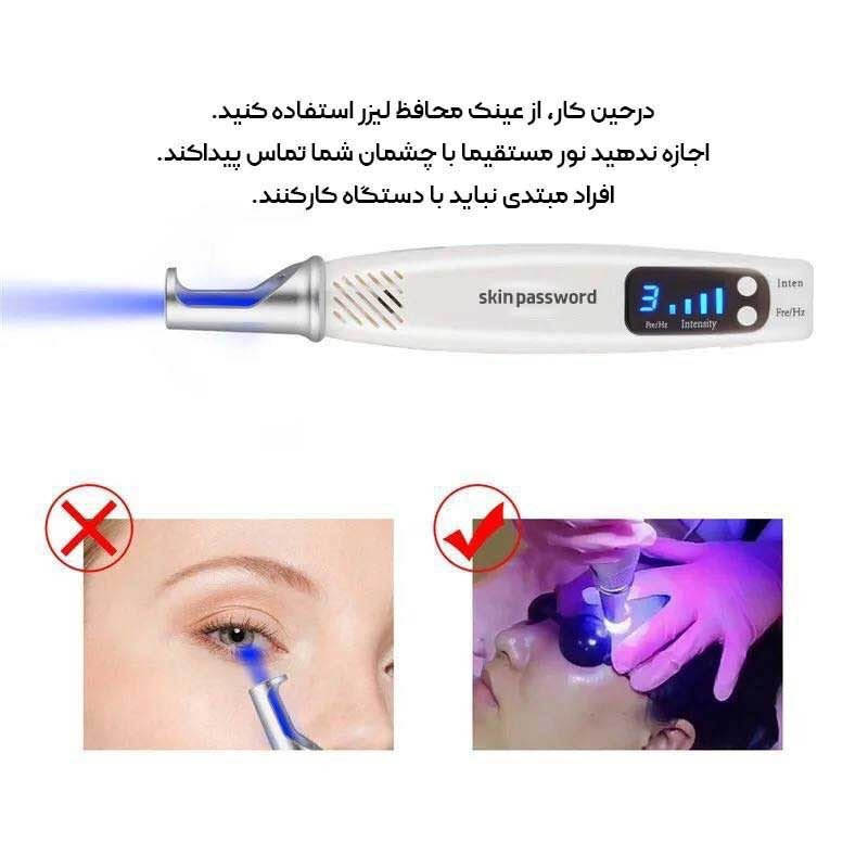 قلم لیزر پاکسازی پوست مدل blue 07