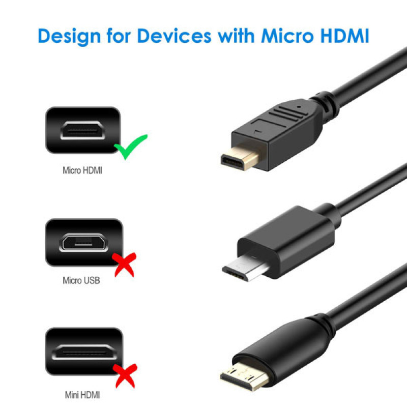 کابل HDMI به Micro HDMI دی نت مدل 7914 طول 1.5 متر