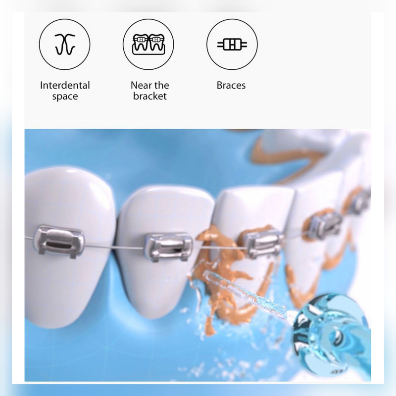 دستگاه شست و شوی دهان و دندان سوکاس مدل Mi W3 PRO
